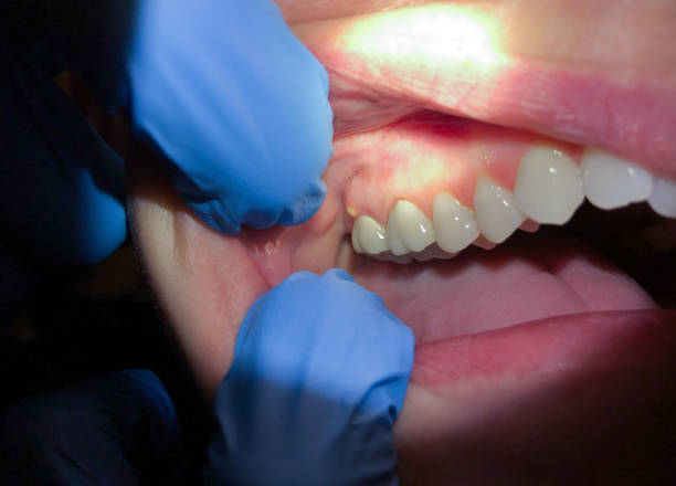 Best Urgent Care for Lost Fillings or Crowns in Crete, IL
